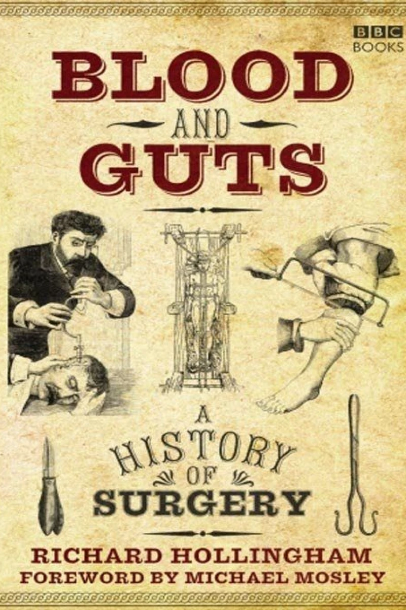 Blood and Guts: A History of Surgery Juliste