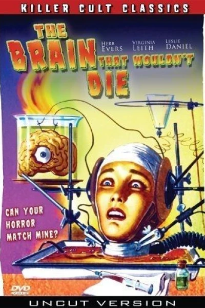 The Brain That Wouldn't Die