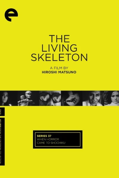 The Living Skeleton